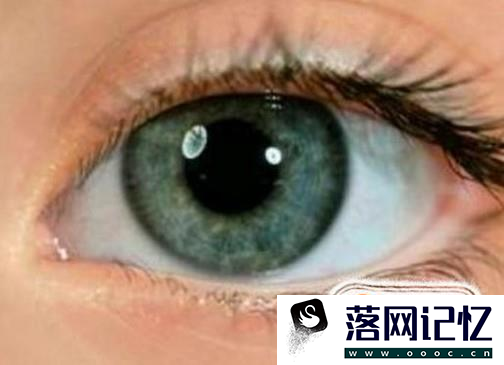 睡着了流眼泪是怎么回事？如何保护眼睛？优质  第3张