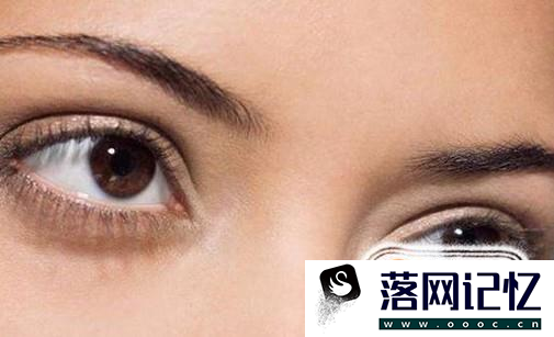 睡着了流眼泪是怎么回事？如何保护眼睛？优质  第8张