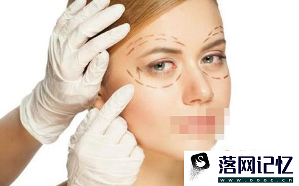 杭州眼角修复优质  第4张