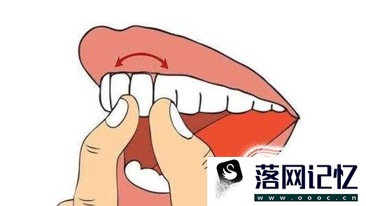 成人牙齿松动应该怎么办？优质  第1张