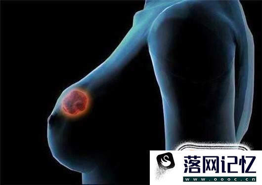 乳房有肿块是什么原因？该如何消除乳房肿块？优质  第1张