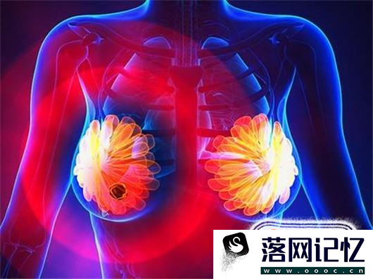 乳房有肿块是什么原因？该如何消除乳房肿块？优质  第6张