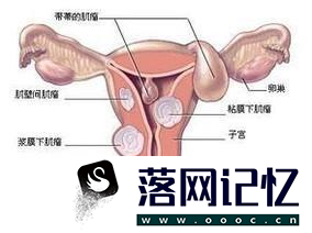 如何保护女人的子宫？优质  第4张