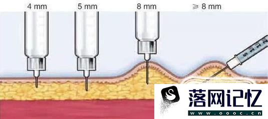 图文详解如何正确规范注射胰岛素优质  第5张