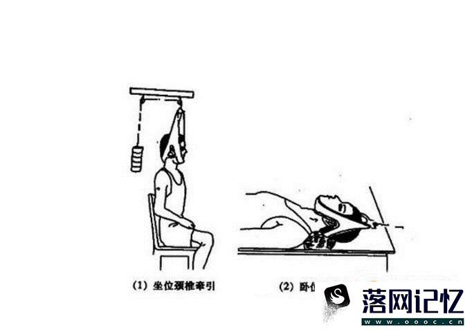 做颈椎牵引有副作用吗优质  第4张