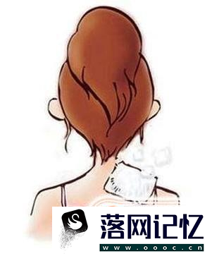 落枕了怎么快速好起来优质  第1张