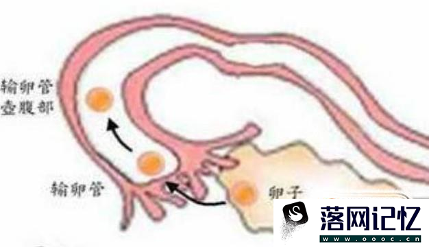 如何判断输卵管是否通畅？揭示4大检查方法优质  第1张