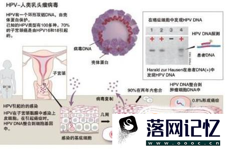 感染HPV病毒一定会得宫颈癌吗优质  第2张