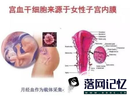 宫血干细胞可以治疗哪些疾病？优质  第1张