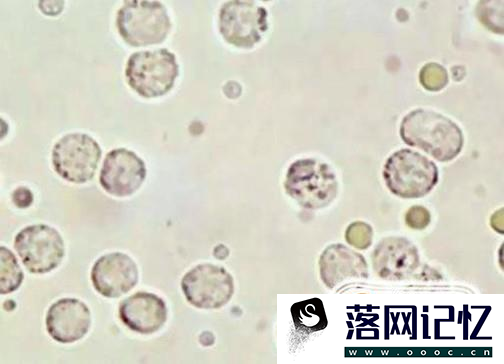 避孕药能够治疗哪些疾病？优质  第5张