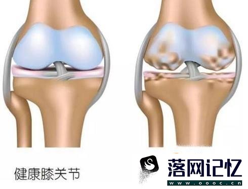 胶原软骨素钙片的作用和适用人群优质  第1张