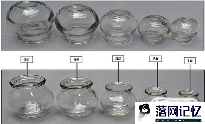 教你在家正确拔火罐优质  第3张