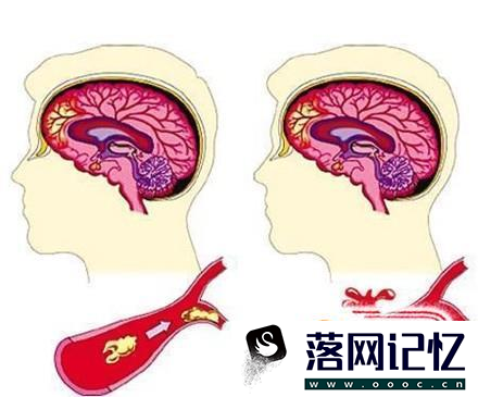 α-亚麻酸对人体的8大作用优质  第1张